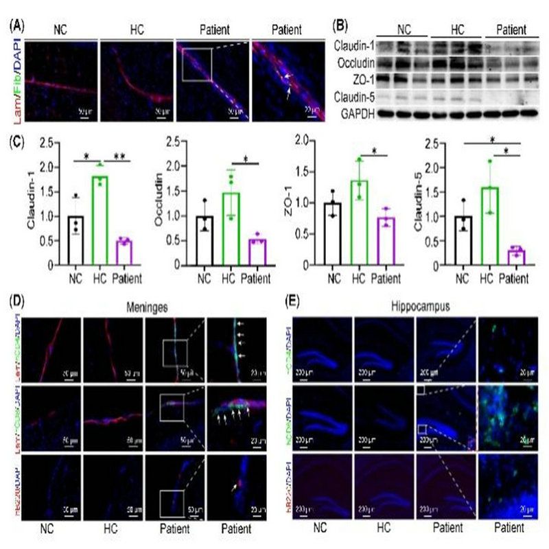 26C2FFE76179CAE47B7BD04562A_72B6D3D3_174F6
