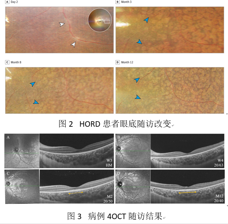 453DEA6B41990DA055289B00B54_46D04DDF_D3D6C