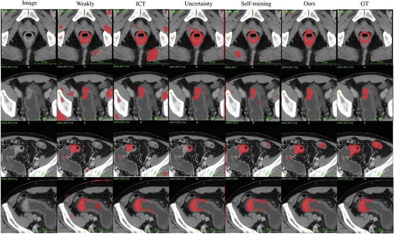 4D7938CC0CF6CA71D3DD7054B75_304418E4_1898E 4D7938CC0CF6CA71D3DD7054B75_304418E4_1898E