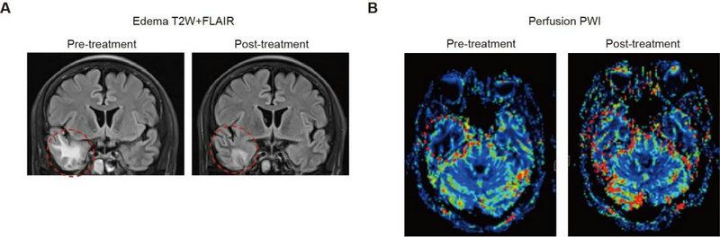 EAF4C50FAFD6FC4D48331F5EDB8_0AFDFAA3_A2BF